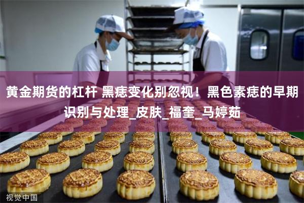 黄金期货的杠杆 黑痣变化别忽视！黑色素痣的早期识别与处理_皮肤_福奎_马婷茹